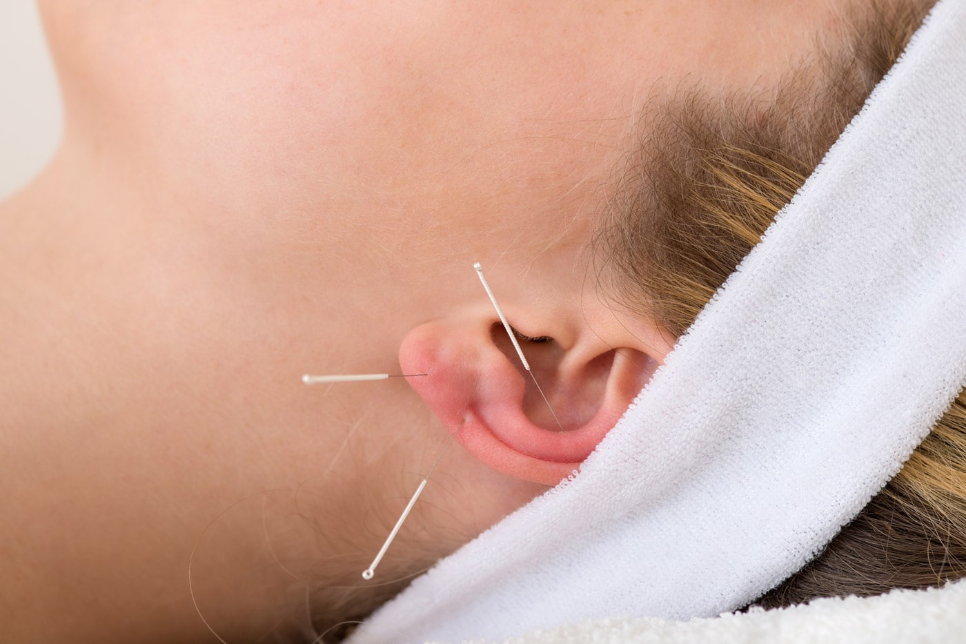 terapia-auriculoterapia-min